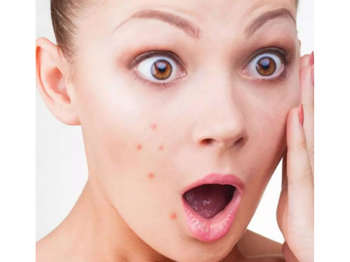Плохо ли влияет основа под макияж на угревую сыпь?